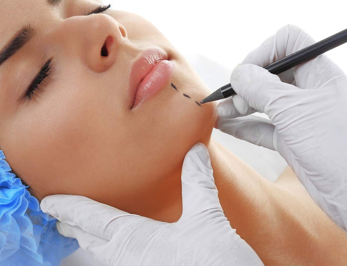 draw line on chin for plastic surgery